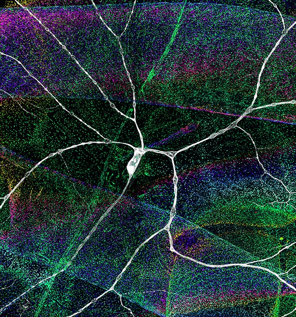 This image shows a nociceptive sensory neuron and surrounding cellular environment in Drosophila larva. Labeling includes a nociceptive neuron and cell surface receptors integrins expressed in both neuron and surrounding substrates. Membrane recycling of integrins in neurons is disrupted in chemotherapy-induced peripheral neuropathy leading to the degeneration of sensory neuron terminals. Image and artwork courtesy of Luke Hammond and Grace Shin.