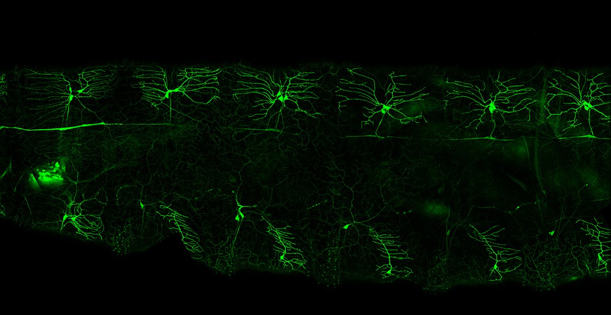 proprioceptive neurons