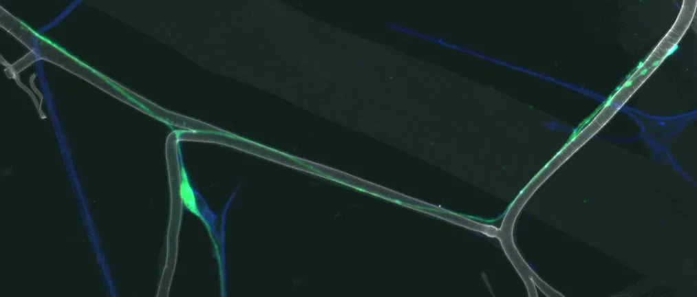 tracheal sensory neuron